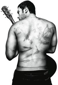 Musican Ramy Essam, scars from his torture by the military after Mubarak's fall