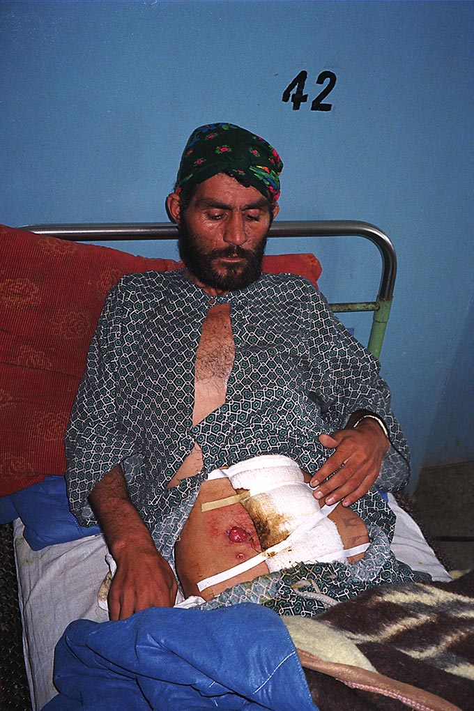 Injured soldier at Qala-i-Jhangi